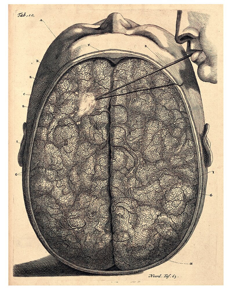 Frederik Ruysch and His Thesaurus Anatomicus: A Morbid Guide