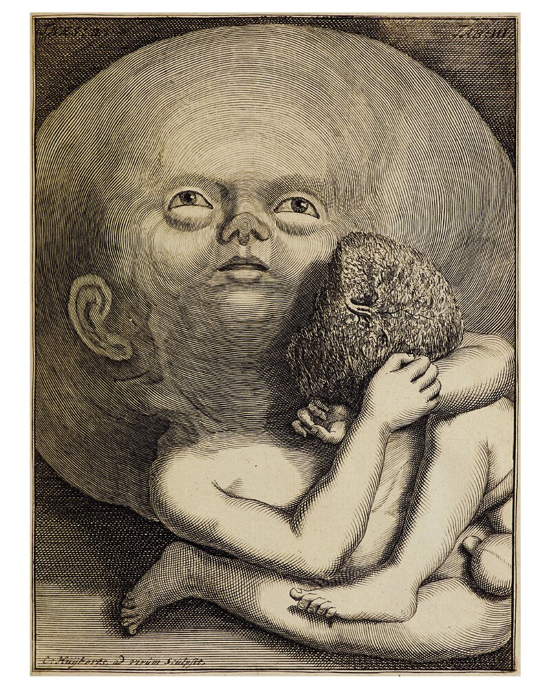 Frederik Ruysch and His Thesaurus Anatomicus: A Morbid Guide