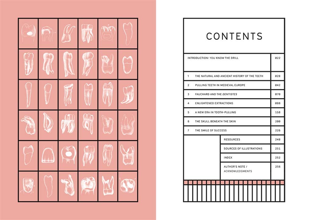 Smile Stealers: The Fine and Foul Art of Dentistry