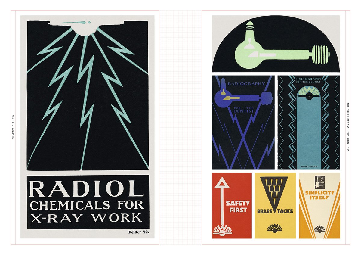 Smile Stealers: The Fine and Foul Art of Dentistry