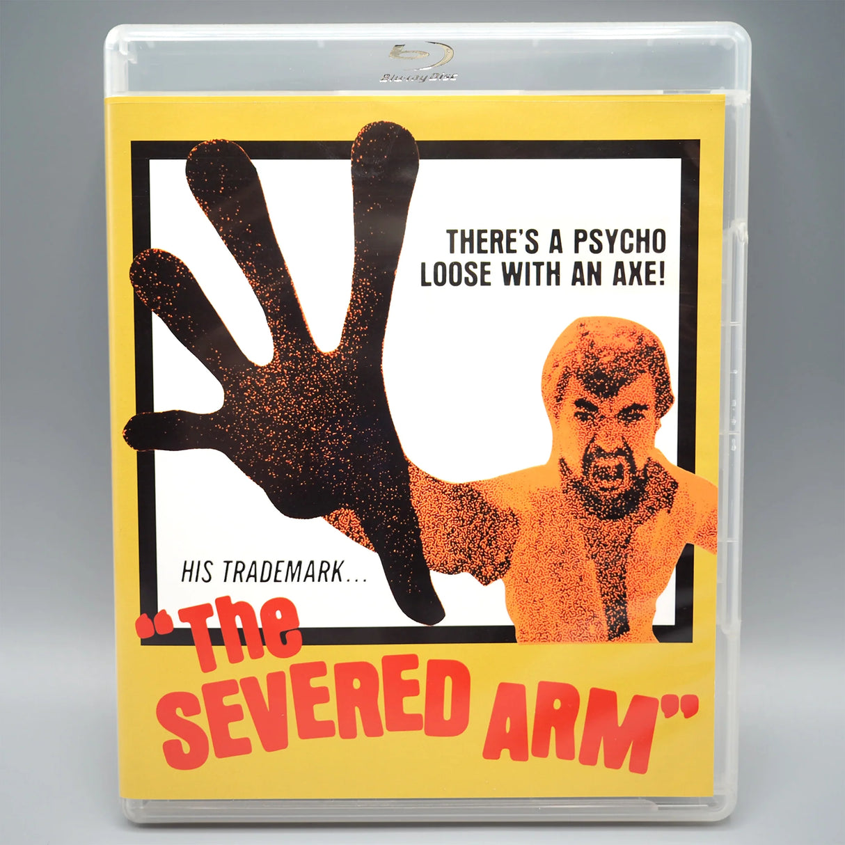 The Severed Arm