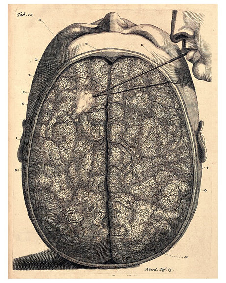 Frederik Ruysch and His Thesaurus Anatomicus: A Morbid Guide