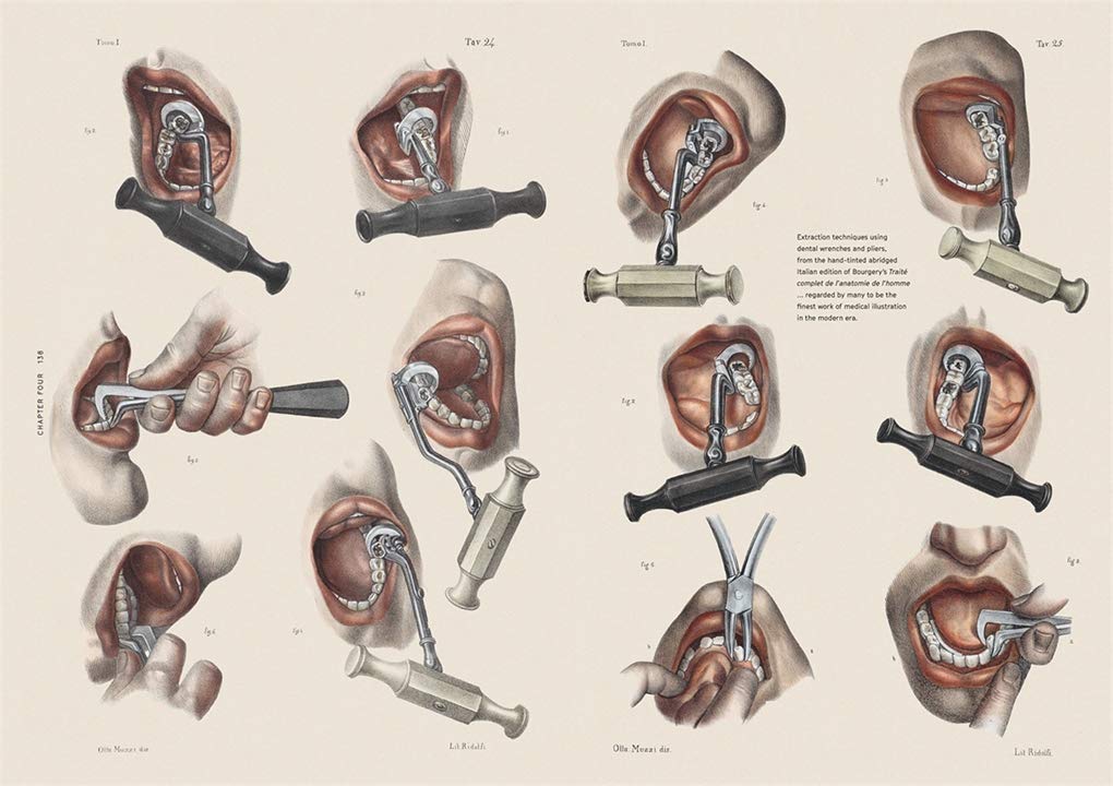 Smile Stealers: The Fine and Foul Art of Dentistry