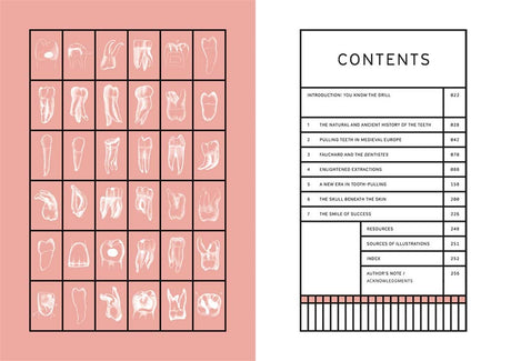 Smile Stealers: The Fine and Foul Art of Dentistry
