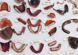 Smile Stealers: The Fine and Foul Art of Dentistry