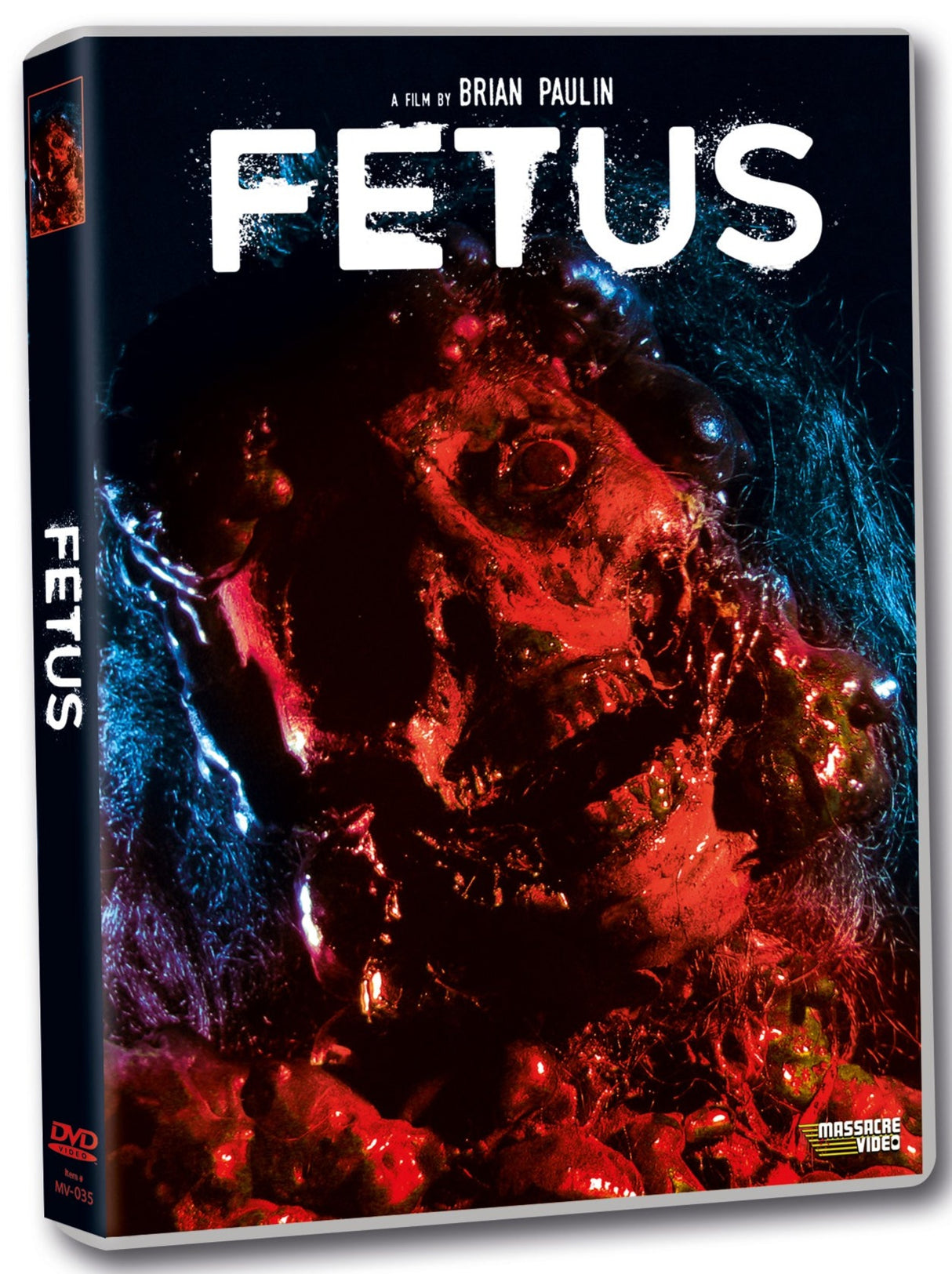 Fetus (DVD)